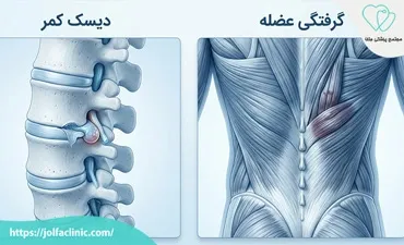 دیسک کمر یا گرفتگی عضله؟