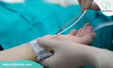 مراقبت بعد از آنژیوگرافی قلب چیست؟