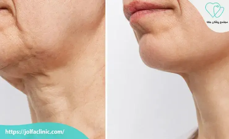 ایجاد تصور اشتباه از زیبایی طبیعی 