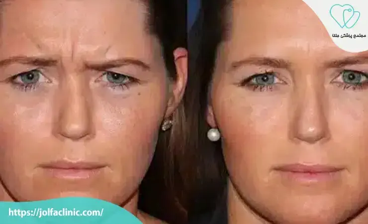 اضطراب و نگرانی از تغییرات ظاهری 