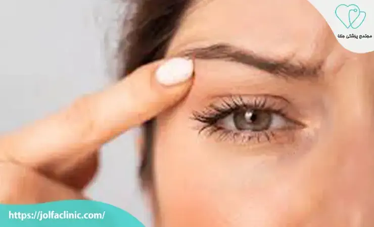 راهکارهای کاهش عوارض بوتاکس 