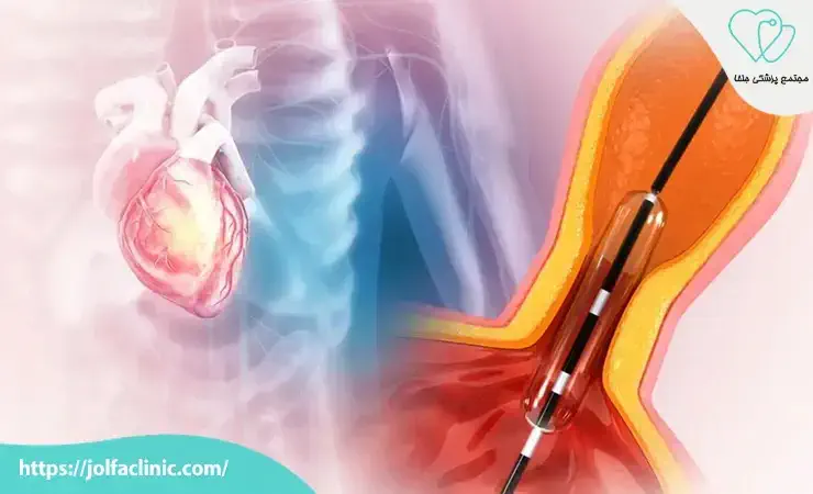 علت بی‌ حالی بعد از آنژیوگرافی چیست؟