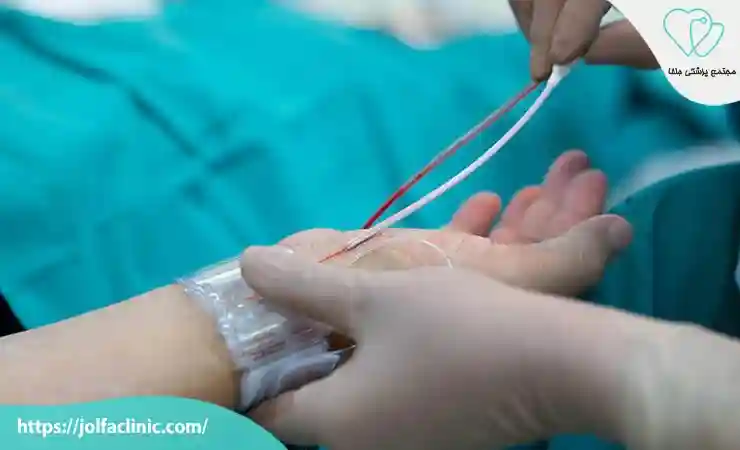 مراقبت بعد از آنژیوگرافی قلب چیست؟