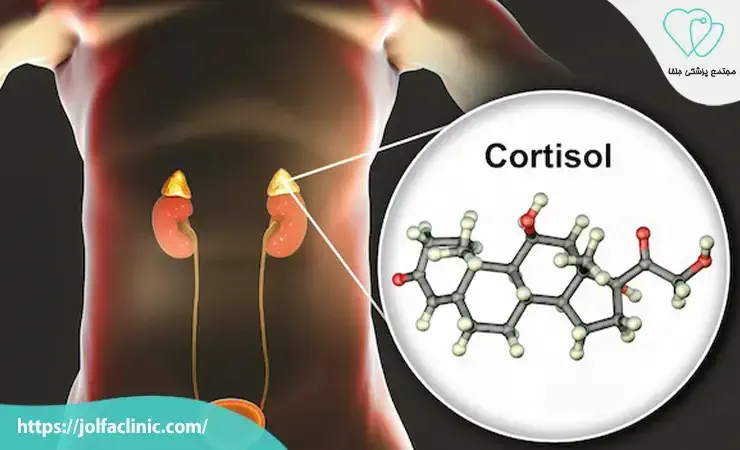 برای درمان کورتیزول بالا به چه دکتری مراجعه کنیم؟