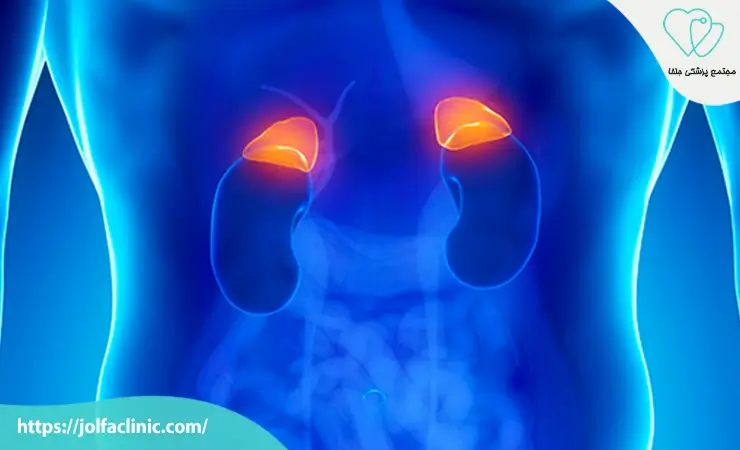 بیماری های غده فوق کلیه