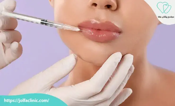مزایای ژل خارجی