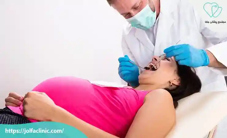 دلایل پوسیدگی دندان در دوران بارداری