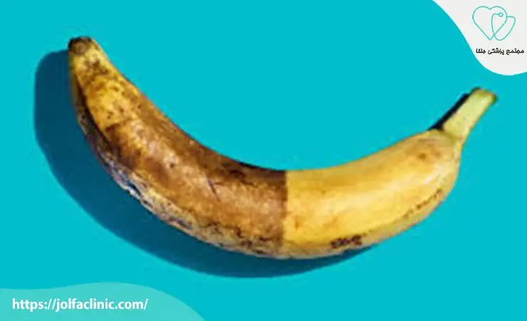 تیرگی پوست ناحیه تناسلی