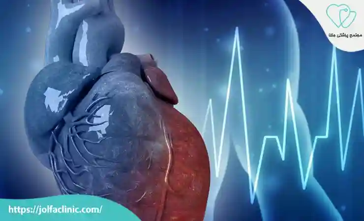 انواع مختلف آریتمی های قلبی