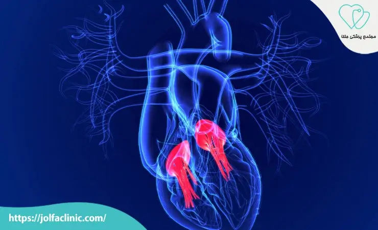 بیماری های دریچه ای قلب