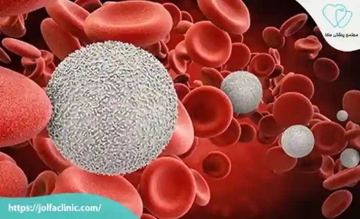 اختلال در جریان خون به مغز