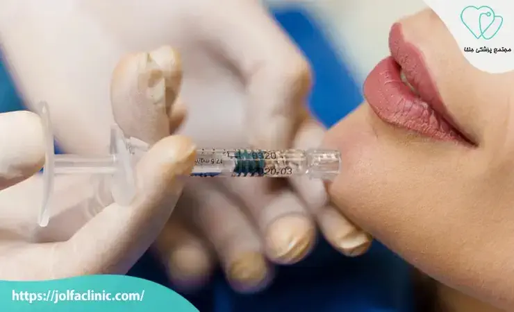قیمت تزریق ژل ایرانی و خارجی