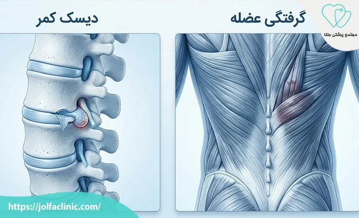 دیسک کمر یا گرفتگی عضله؟