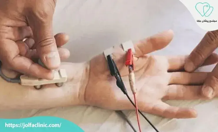 Nerve Conduction Study - NCS