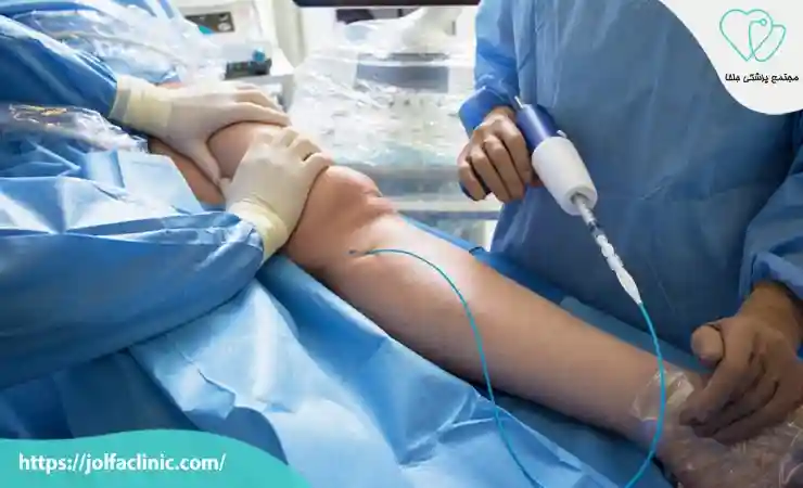 طول عمر بیماران آنژیوپلاستی