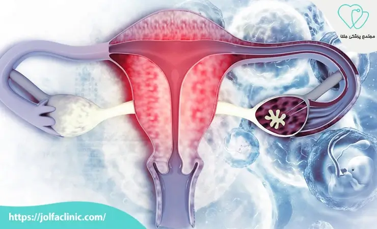 اختلالات هورمون های جنسی