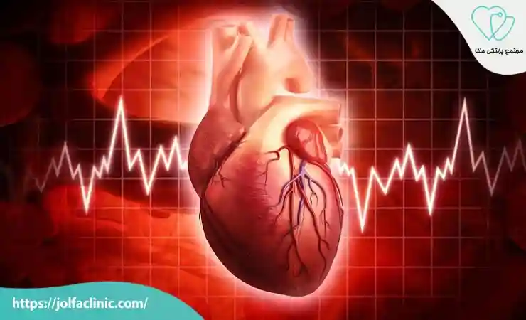 تاکی کاردی فوق بطنی