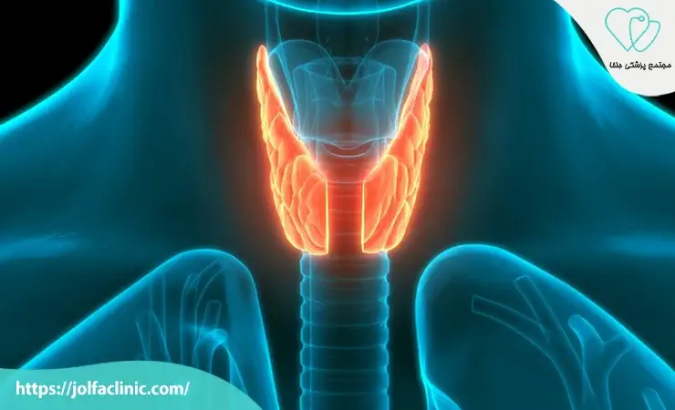 مشکلات تیروئید