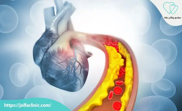 علائم هشدار دهنده بیماری عروق کرونر قلب