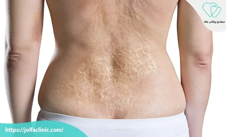 افراد مبتلا به بیماری های پوستی فعال