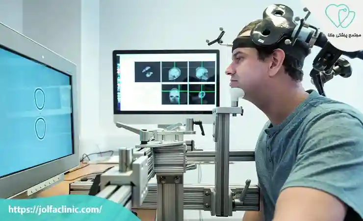 درمان افسردگی با دستگاه TDCS برای چه کسانی مناسب است؟