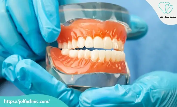 مزایای استفاده از پروتز دندان