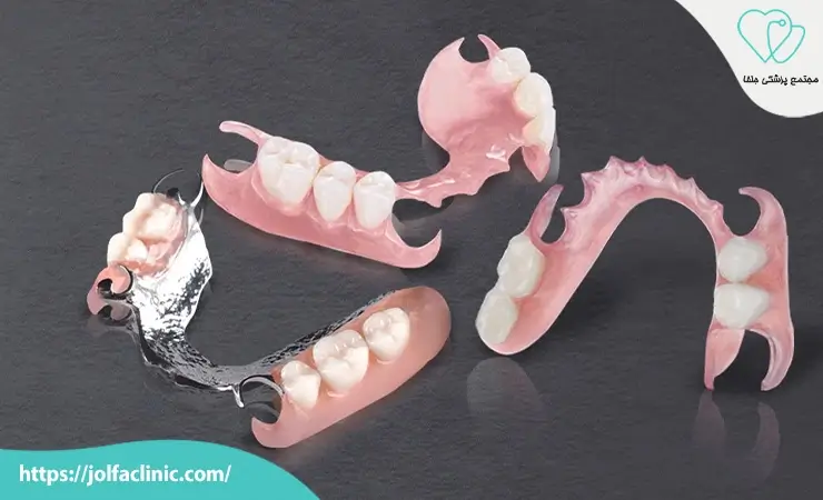 پروتز دندان انعطاف پذیر