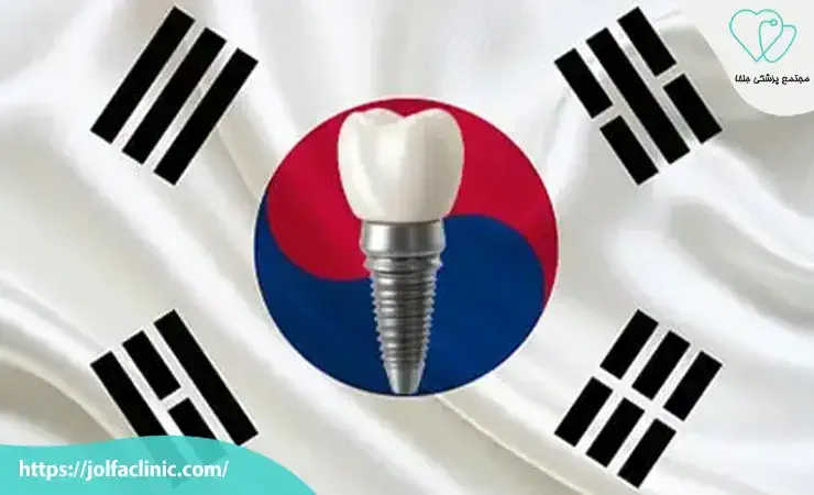 ایمپلنت های کره ای