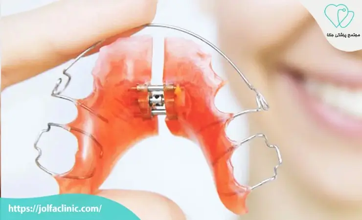 ارتودنسی متحرک