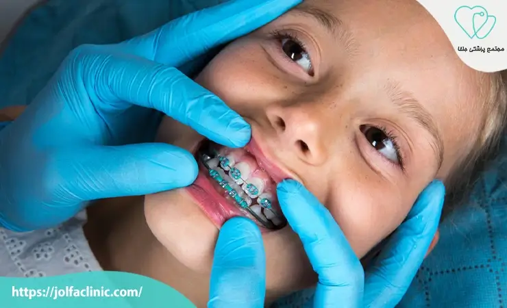 بهترین سن برای ارتودنسی