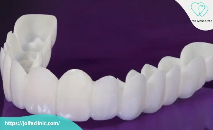 کدام نوع لمینت برای شما بهتر است؟