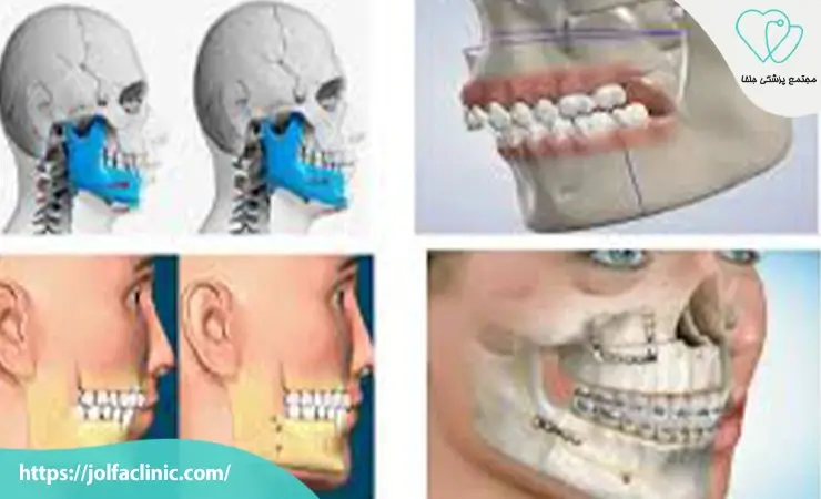 مزایای جراحی دهان و فک و صورت