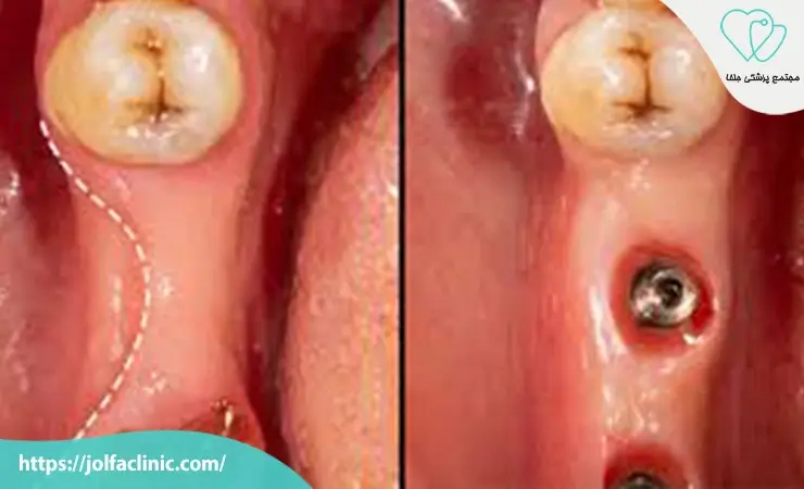 جراحی اصلاحی فک