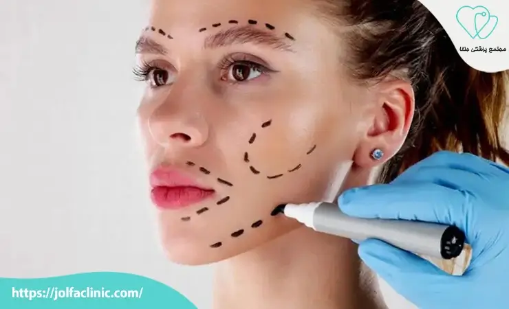 جراحی مفصل فکی