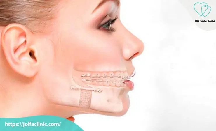 هزینه جراحی دهان و فک و صورت چقدر است؟