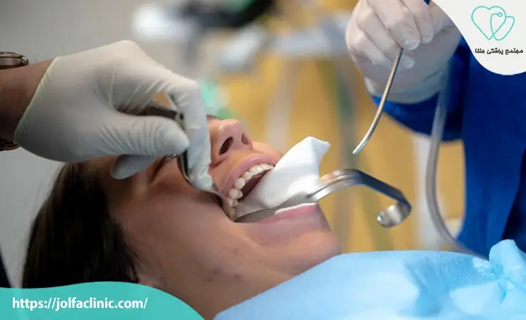 انواع جراحی های دهان و فک و صورت