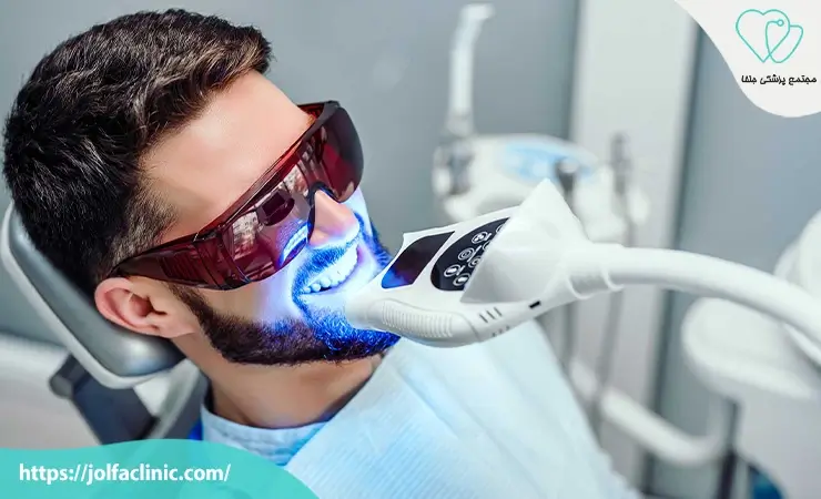 بلیچینگ دندان در مطب