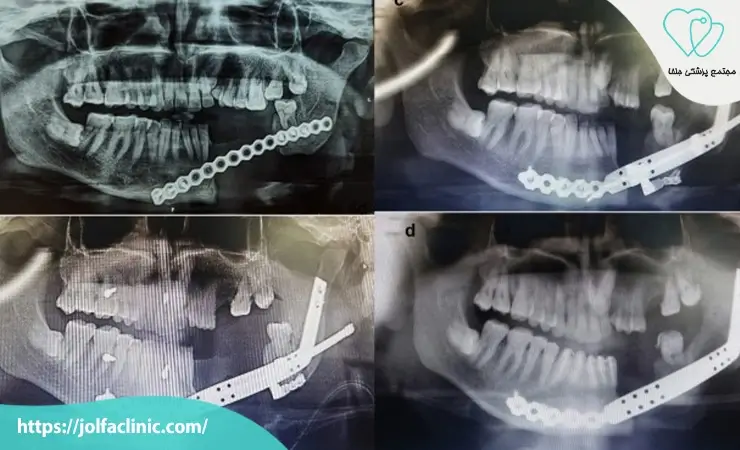جراحی های زیبایی صورت