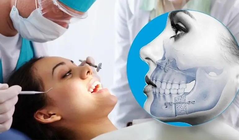 جراحی دهان و فک و صورت