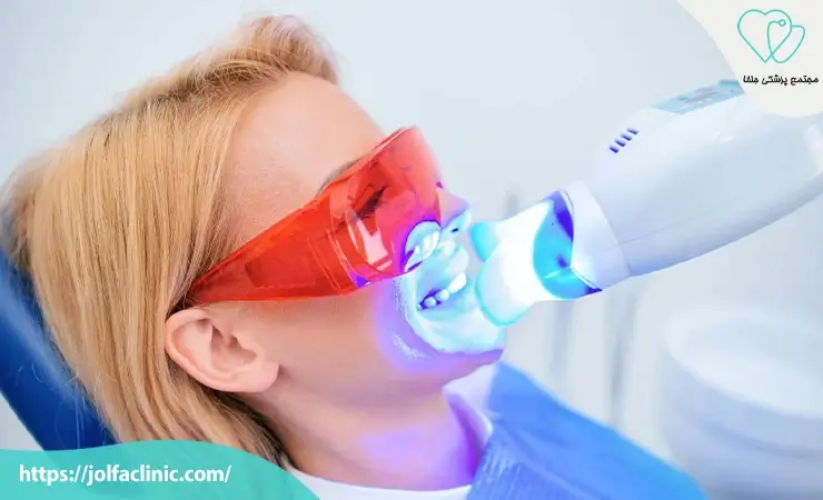 هزینه بلیچینگ دندان
