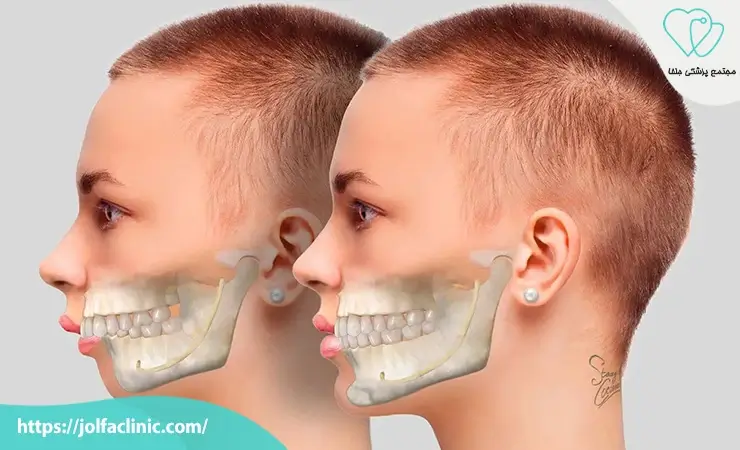 جراحی دهان و فک و صورت چیست؟