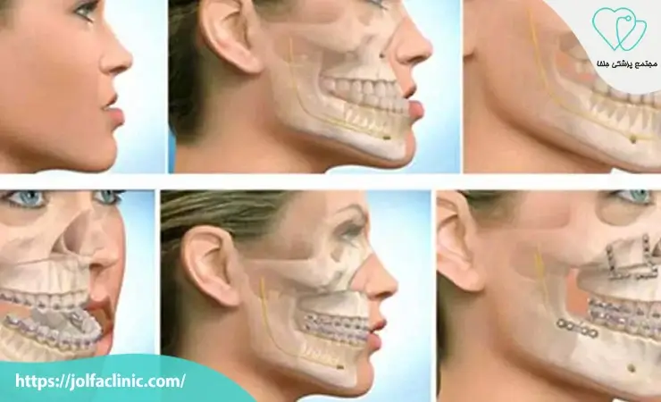 چه زمانی به جراح دهان و فک و صورت مراجعه کنیم؟